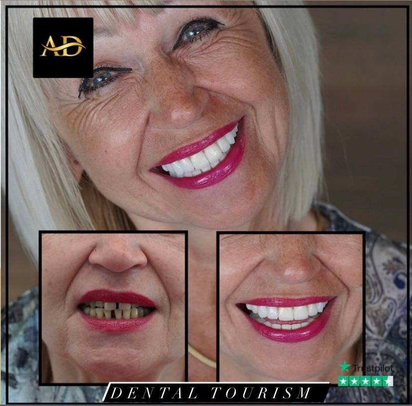 Почему выбирают Аланию для стоматологического туризма?